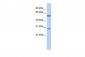 PRRC1 antibody - middle region